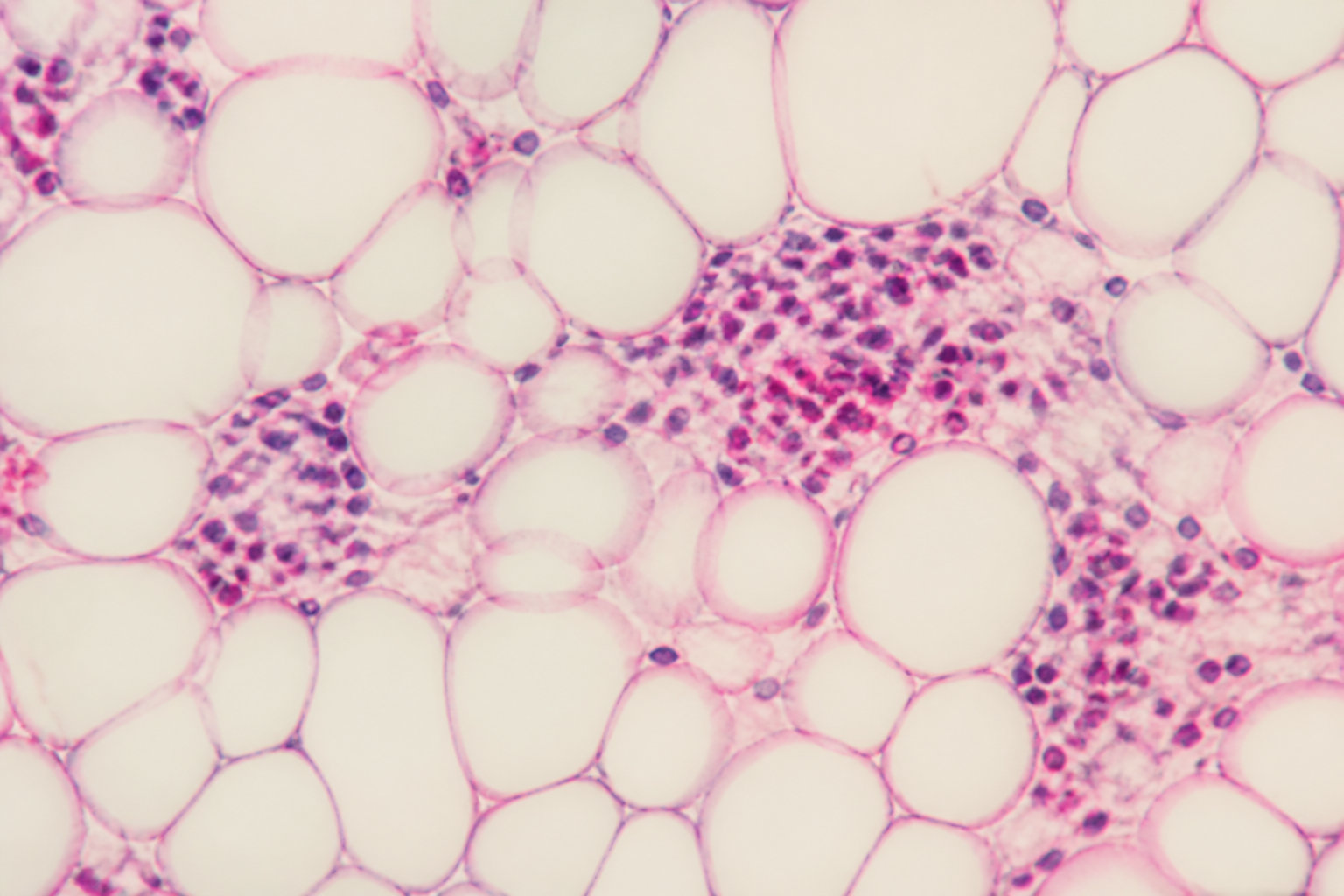 3 mécanismes biologiques qui expliquent la mémoire de l'obésité
