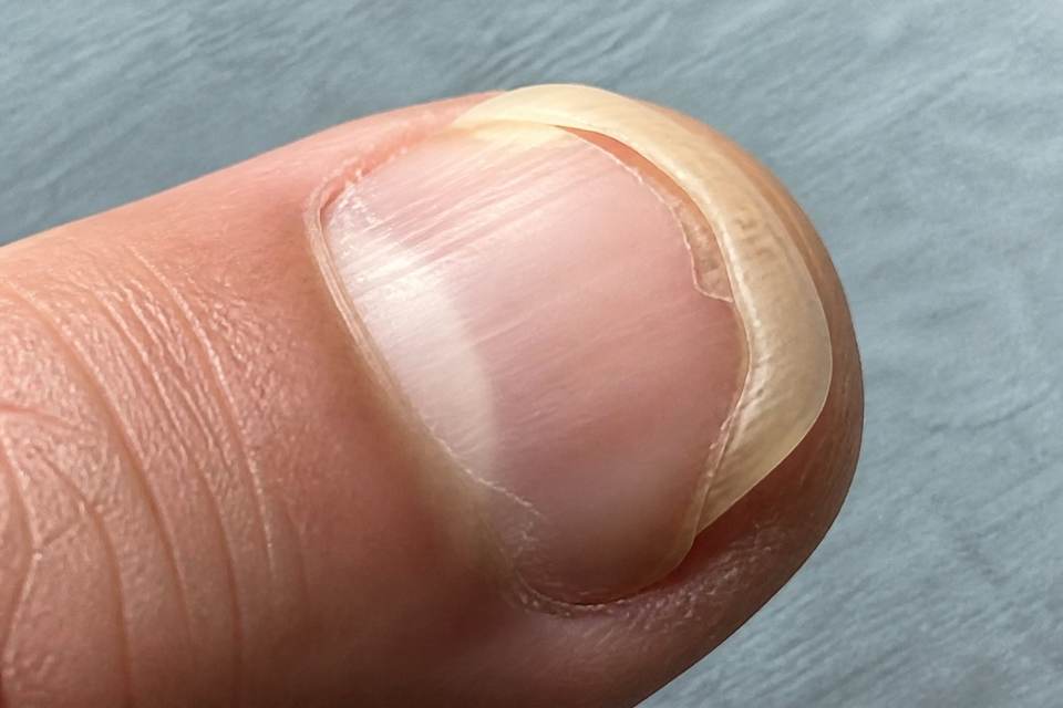 Préservation quotidienne : l'art de protéger ses ongles