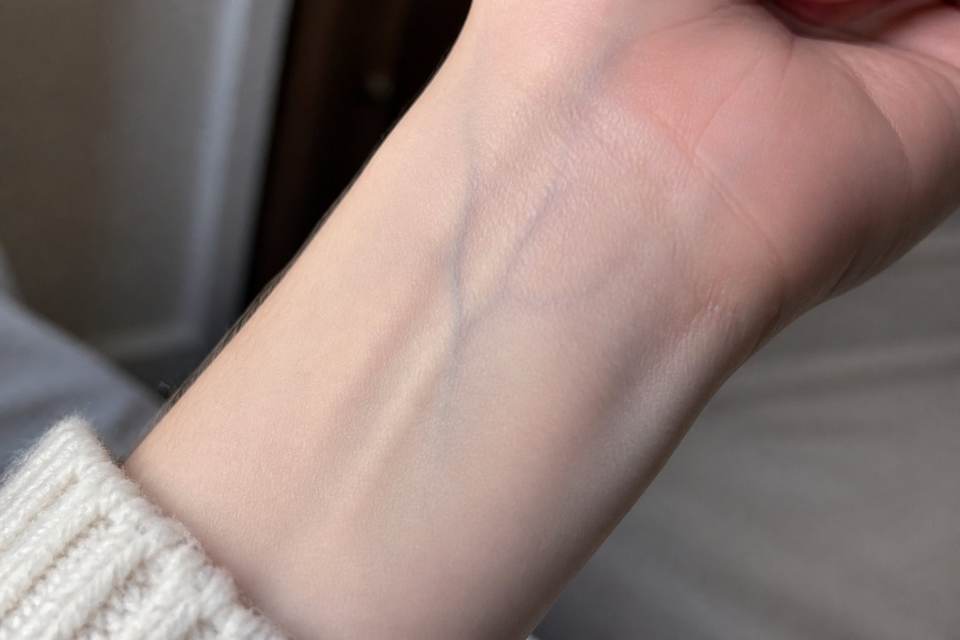 Diagnostic personnel : déchiffrer les signaux de votre pigmentation